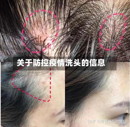 关于防控疫情洗头的信息-第2张图片